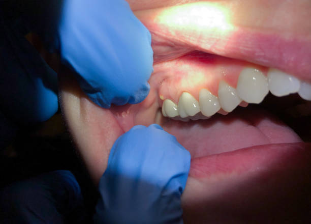 Best Pediatric Emergency Dentist in Centre Hall, PA