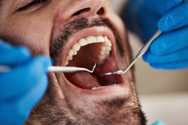 Best Emergency Treatment for Dental Infections or Abscesses in Centre Hall, PA